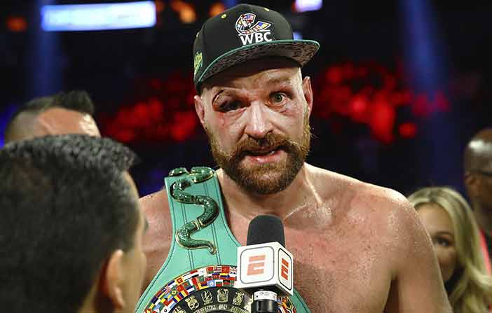 Tyson Fury cortado ( Fotos: Mikey Williams/Top Rank)